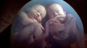 Two babies in the womb